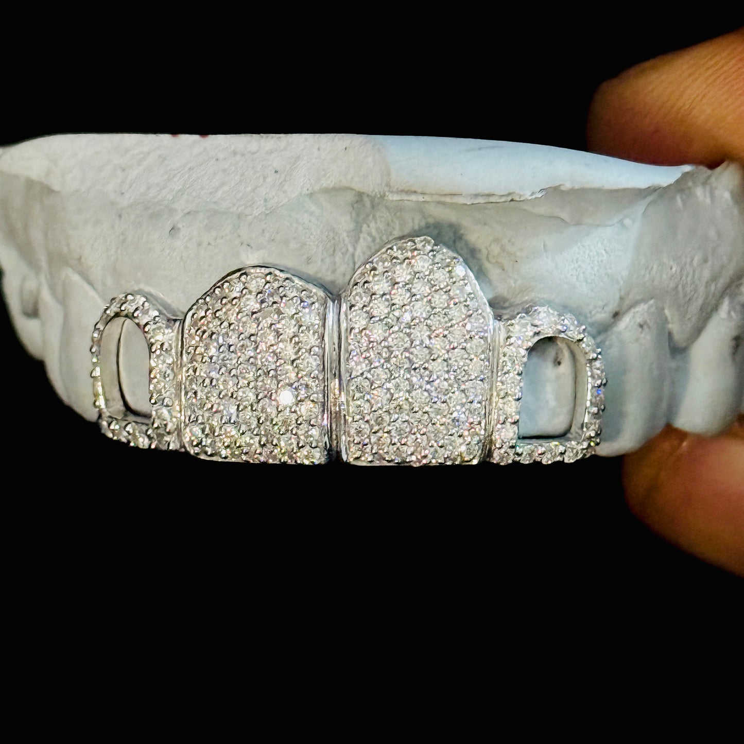 VVS Moissanite Icedout Unisex Grillz