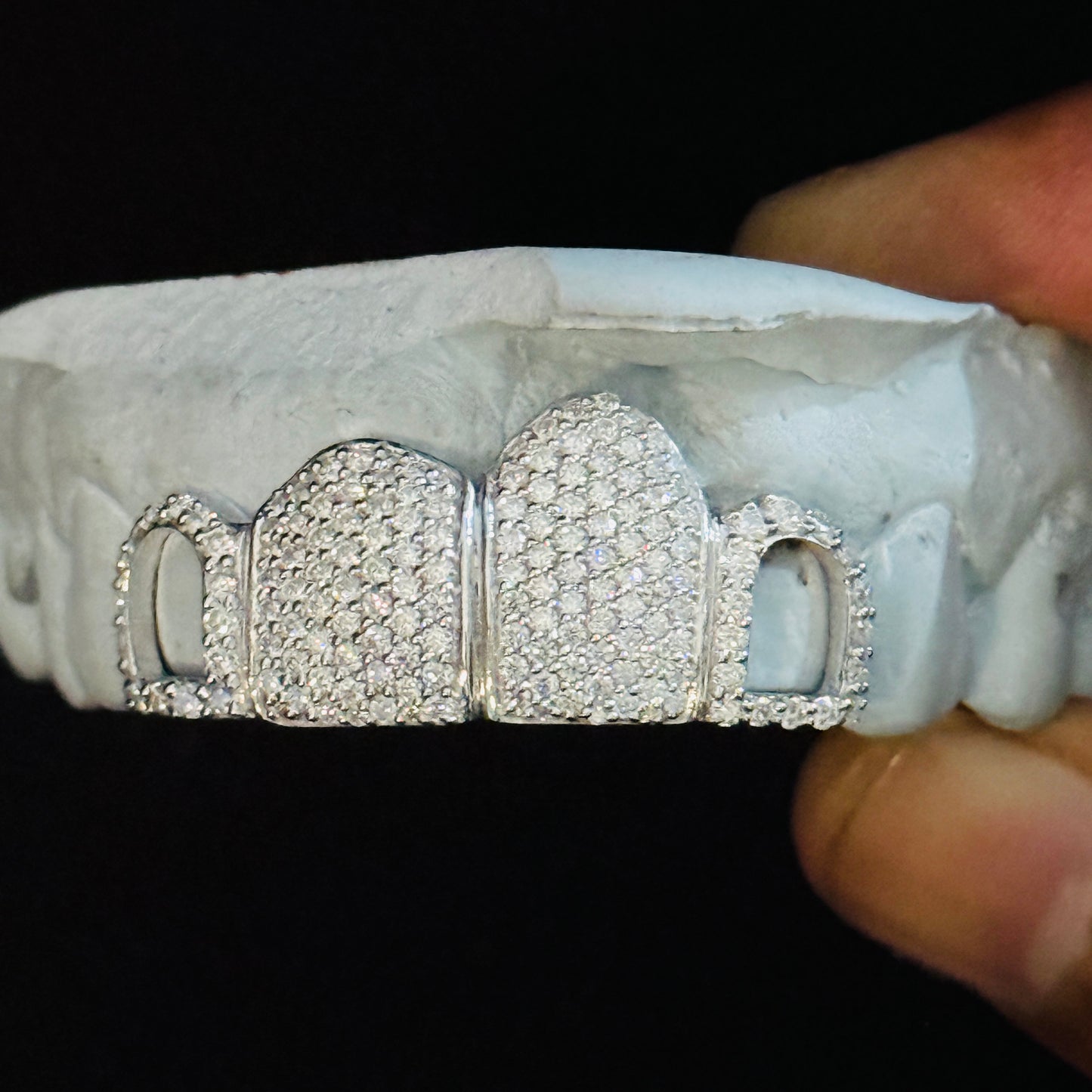 VVS Moissanite Icedout Unisex Grillz