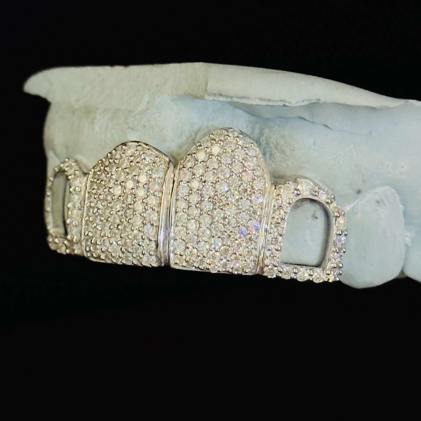 VVS Moissanite Icedout Unisex Grillz