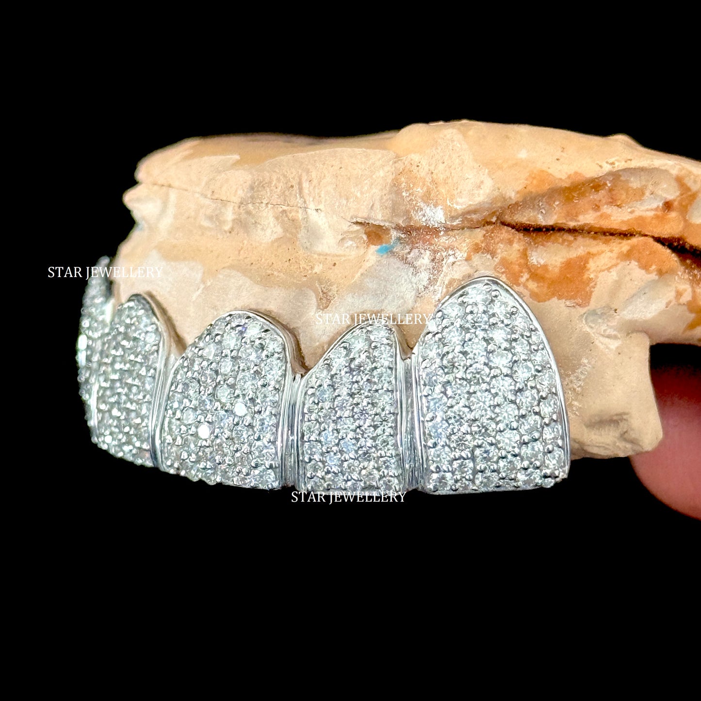 VVS Moissanite Icedout Grillz