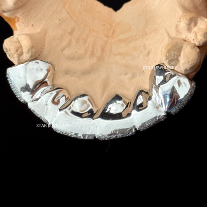 VVS Moissanite Icedout Grillz